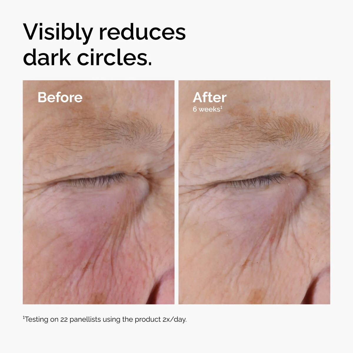 ord-caffeine-solution-egcg-dark-circles-before-after