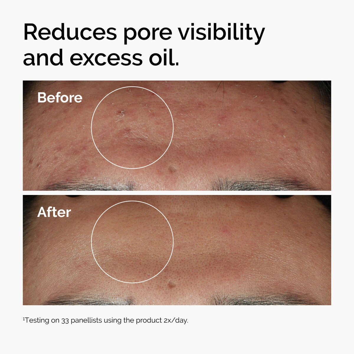 ord-niacinamide-zinc-blemish-serum-before-after-pores